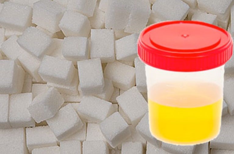 вопрос теста Содержание сахара в моче
